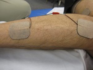 2 elektroden die met plakkers zijn vastgezet been