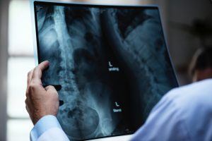 een röntgenfoto van een rug die door een arts wordt bekeken